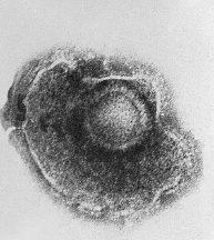 수두대상포진바이러스