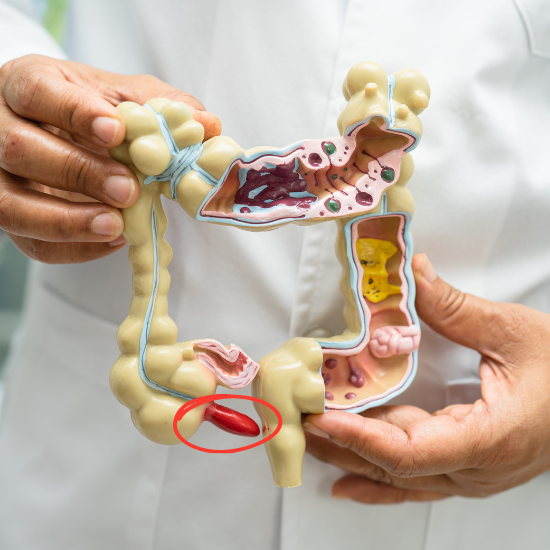 맹장염(충수돌기염)위치