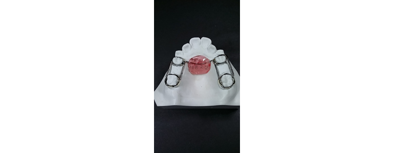 부천 원미구 교정 치과