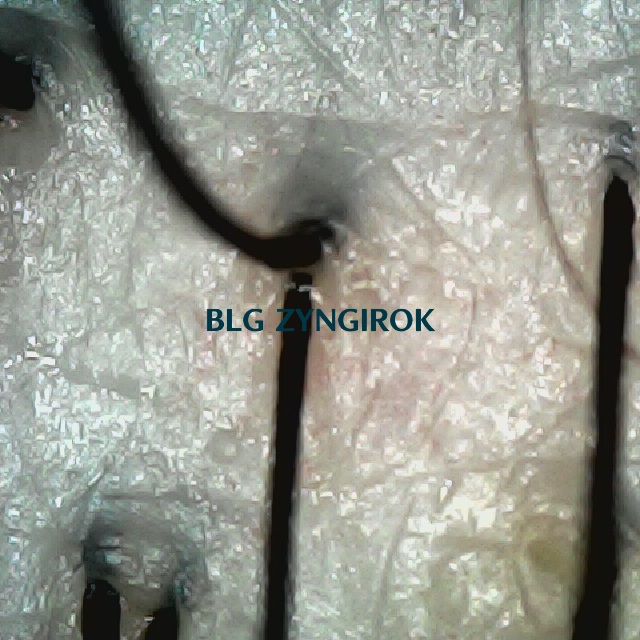 탈모 극복 프로젝트 - 뒷머리 두피 모습이다.