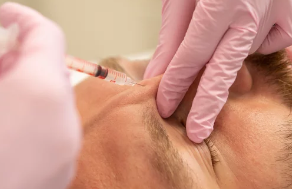 콜라겐 결핍증/출처:어도비스톡