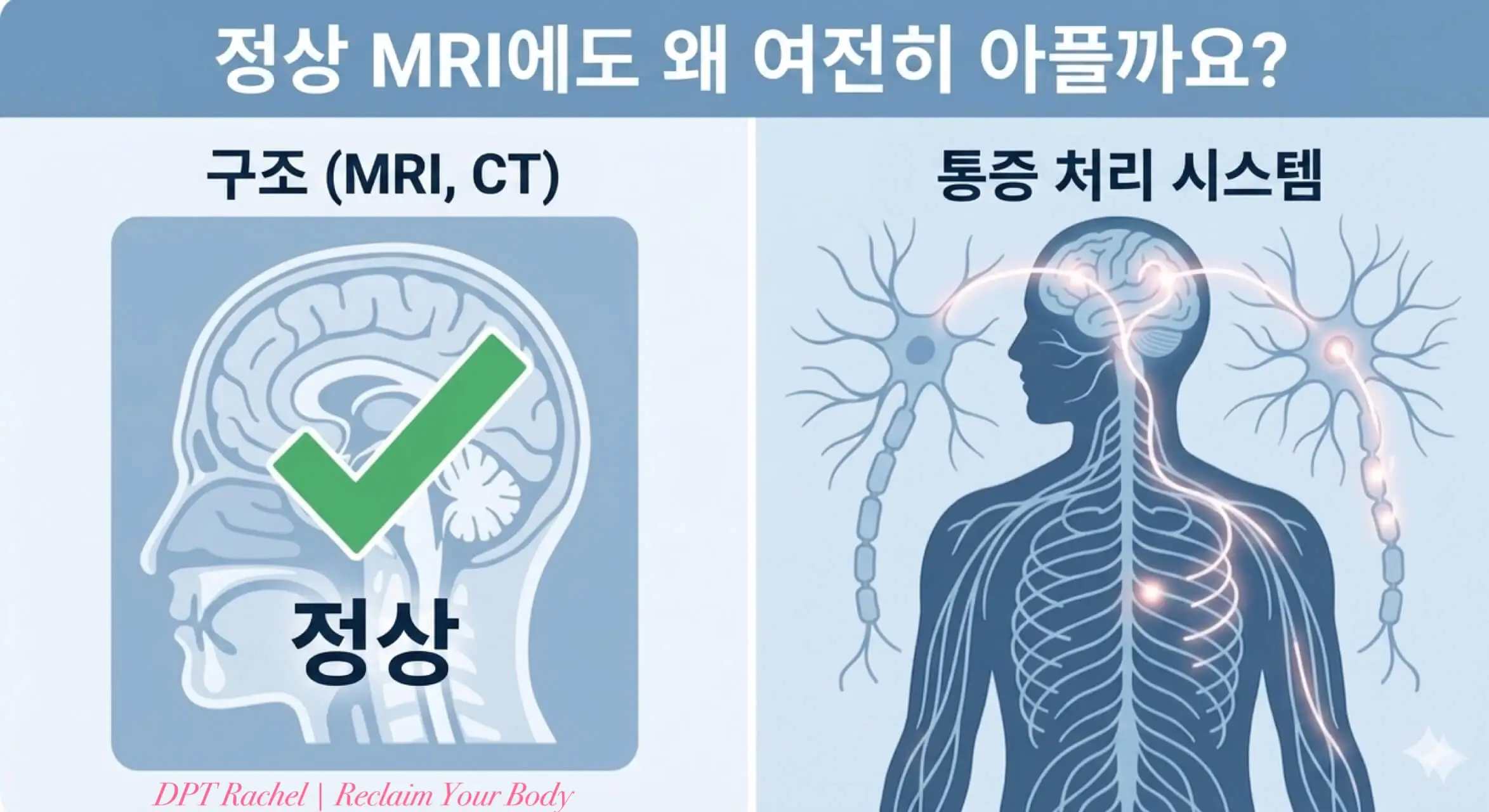MRI는 정상인데 통증이 지속되는 이유를 구조 검사와 신경계 기능 차이로 설명하는 인포그래픽
