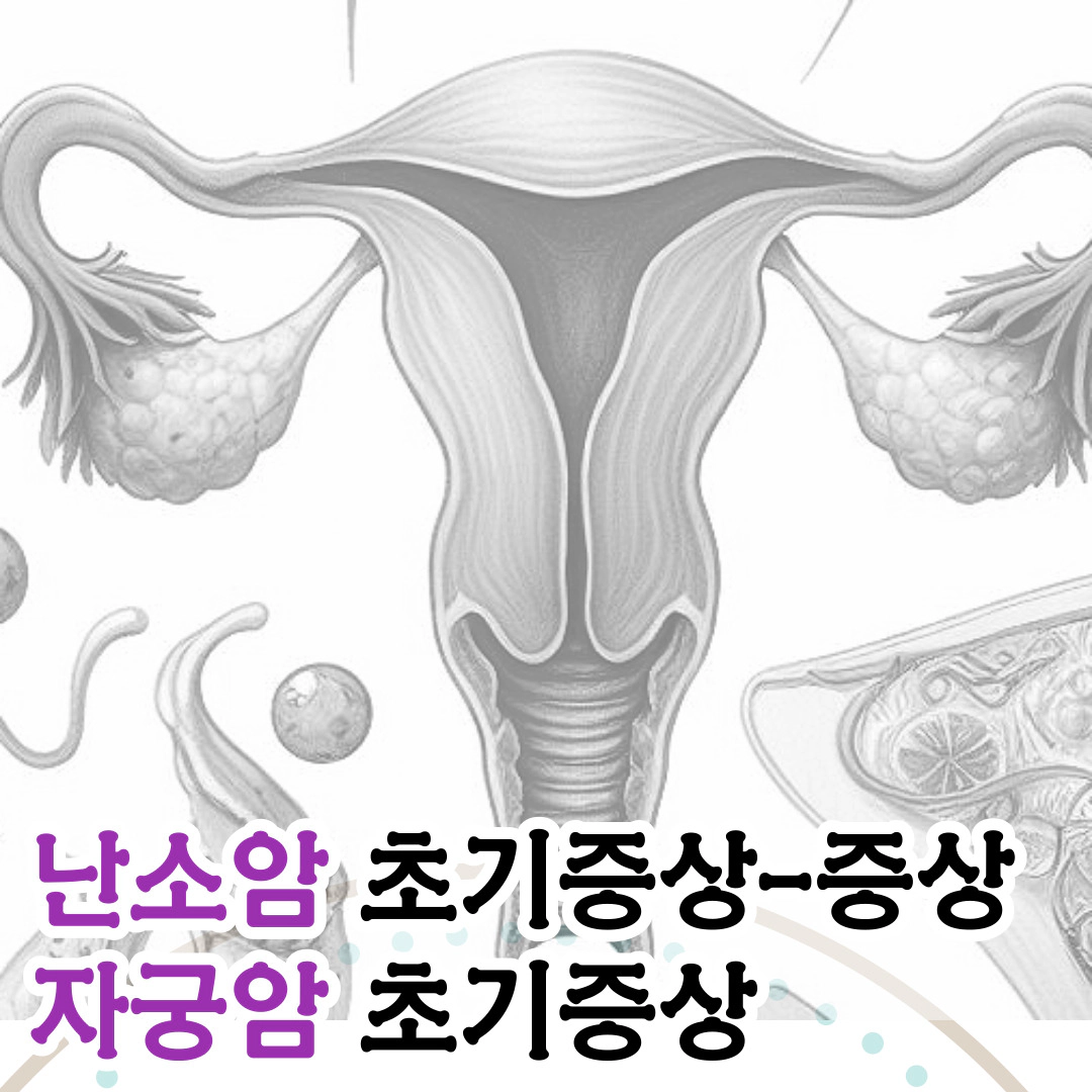 난소암 초기증상-증상 vs 자궁암 초기증상