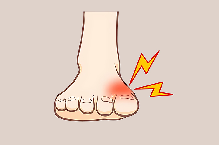 관절-부종이-있는-발