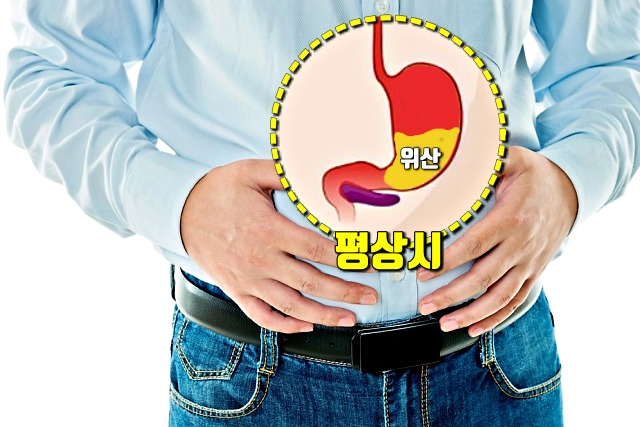 속쓰림,왼쪽으로 누워자면,위안좋을때증상,팁줌