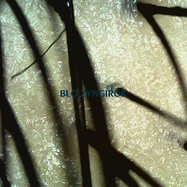 탈모 극복 프로젝트 - 정수리 두피 모습이다.