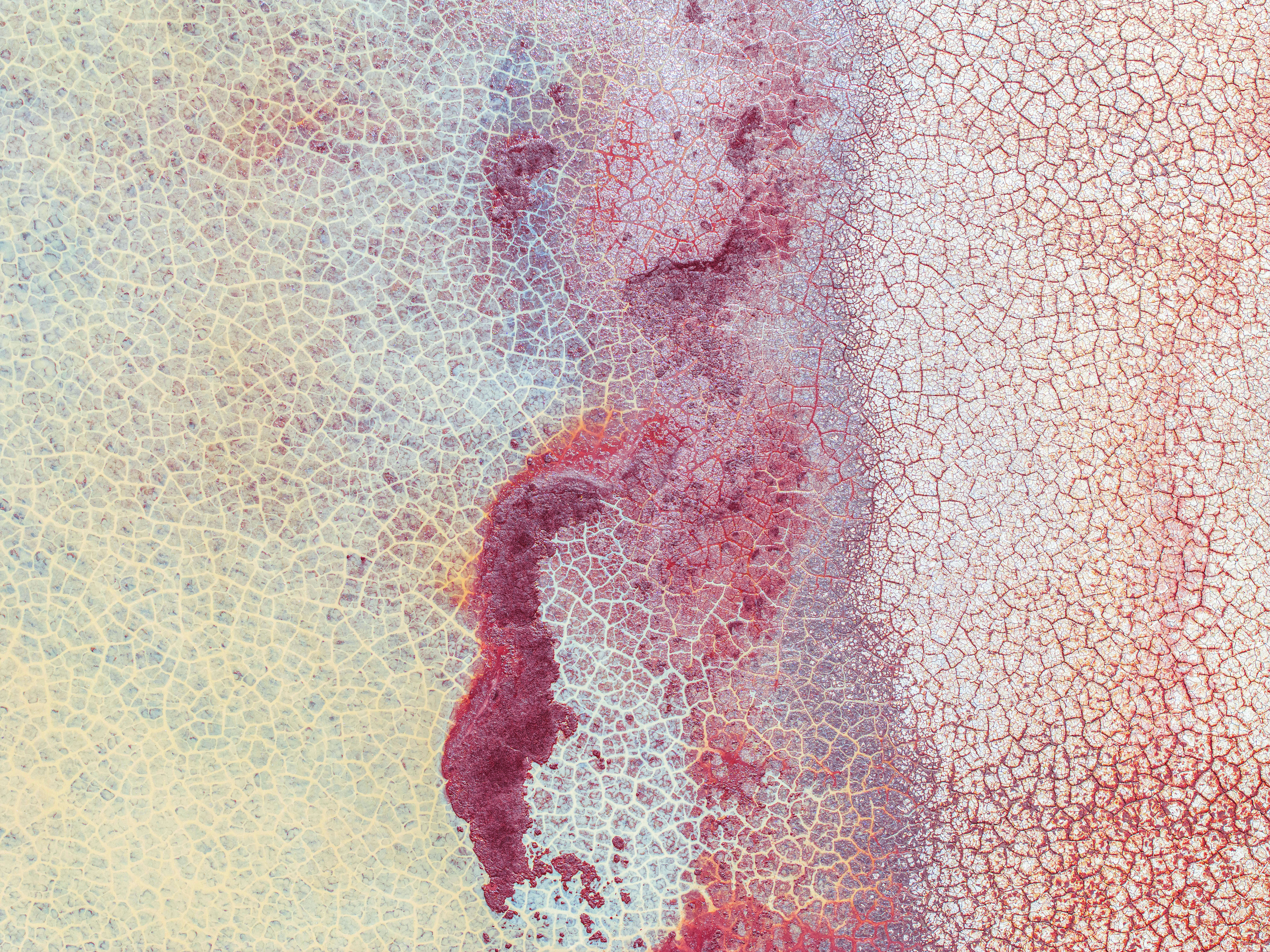 인천 대상포진 무료점종