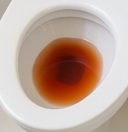 혈뇨가 나오는 이유