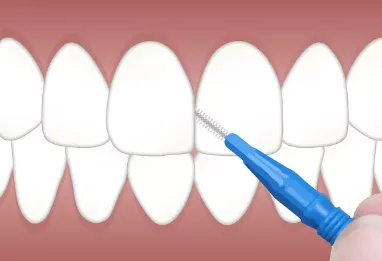 잇몸이-붓고-아플때-이유-해결방법-건강