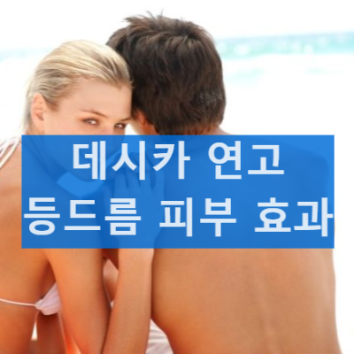 데시카 등드름연고 효과 및 성분 내돈내산 후기 사용 시 주의사항 알기