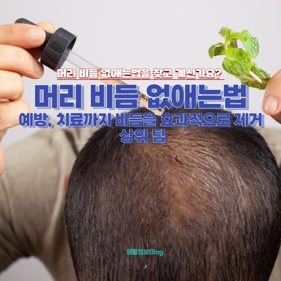 머리 비듬 없애는법을 찾고 계신가요?