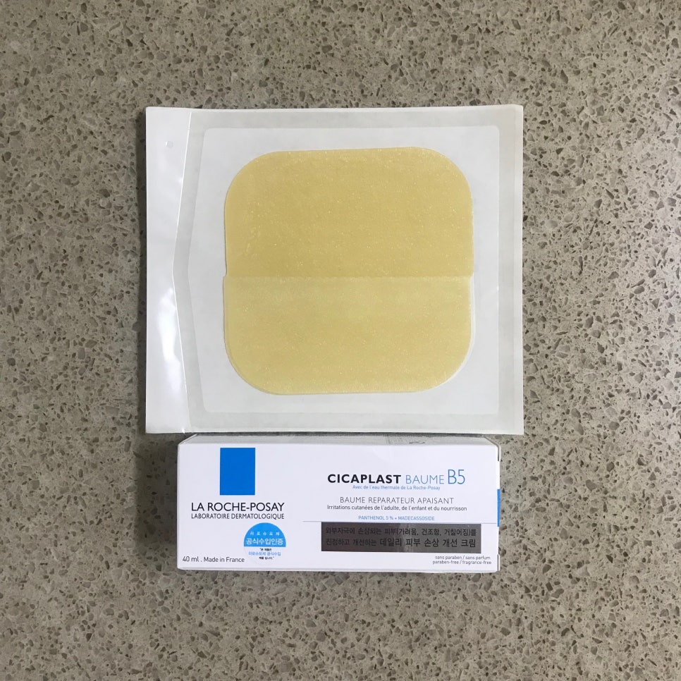 편평사마귀 레이저 치료 후기