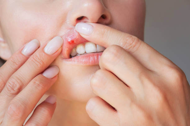 2025년 베체트 병 치료 잘하는 병원 최신 리스트!