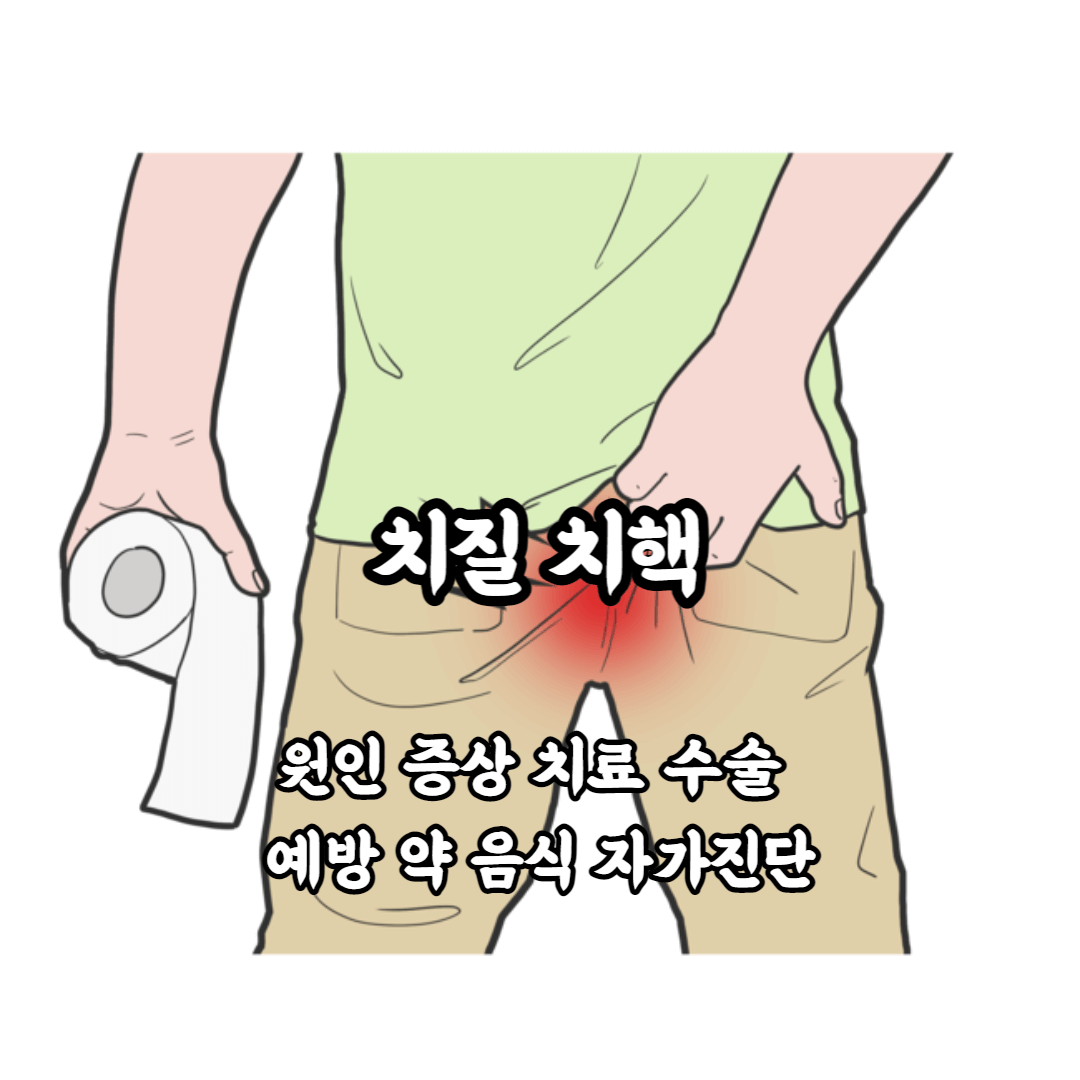치질 치핵 원인 증상 치료 수술 예방 약 음식 자가진단