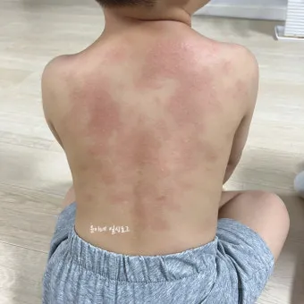 고양이 털 알레르기 완화 방법과 생활 관리 팁_15