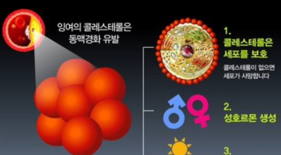 콜레스테롤 이미지