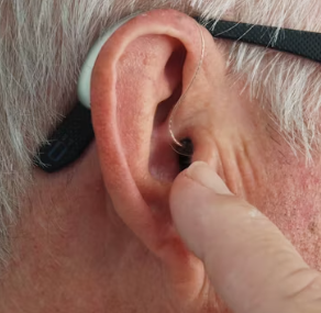 난청이란 원인 증상 치료 방법