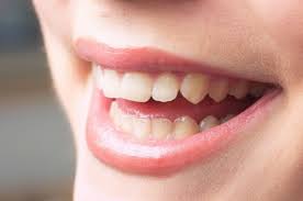 잇몸에서 피가 나는 이유