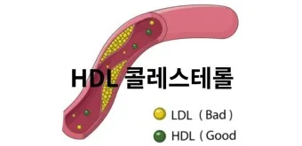 LDL 콜레스테롤 정상수치 낮추는법_4