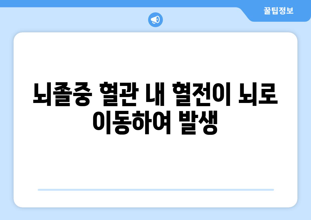 뇌졸중 혈관 내 혈전이 뇌로 이동하여 발생
