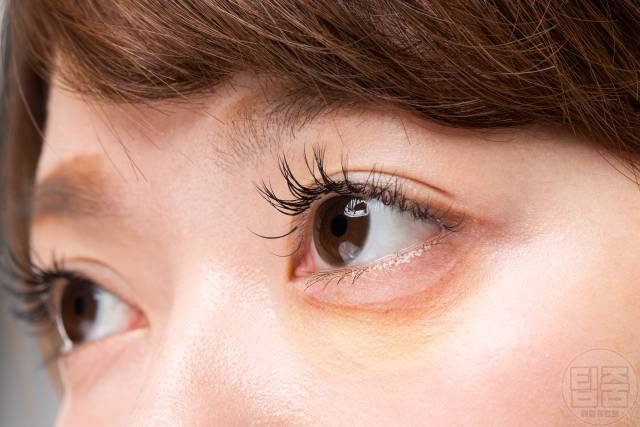 다크서클 원인 아이크림 추천 눈밑처짐 눈밑지방