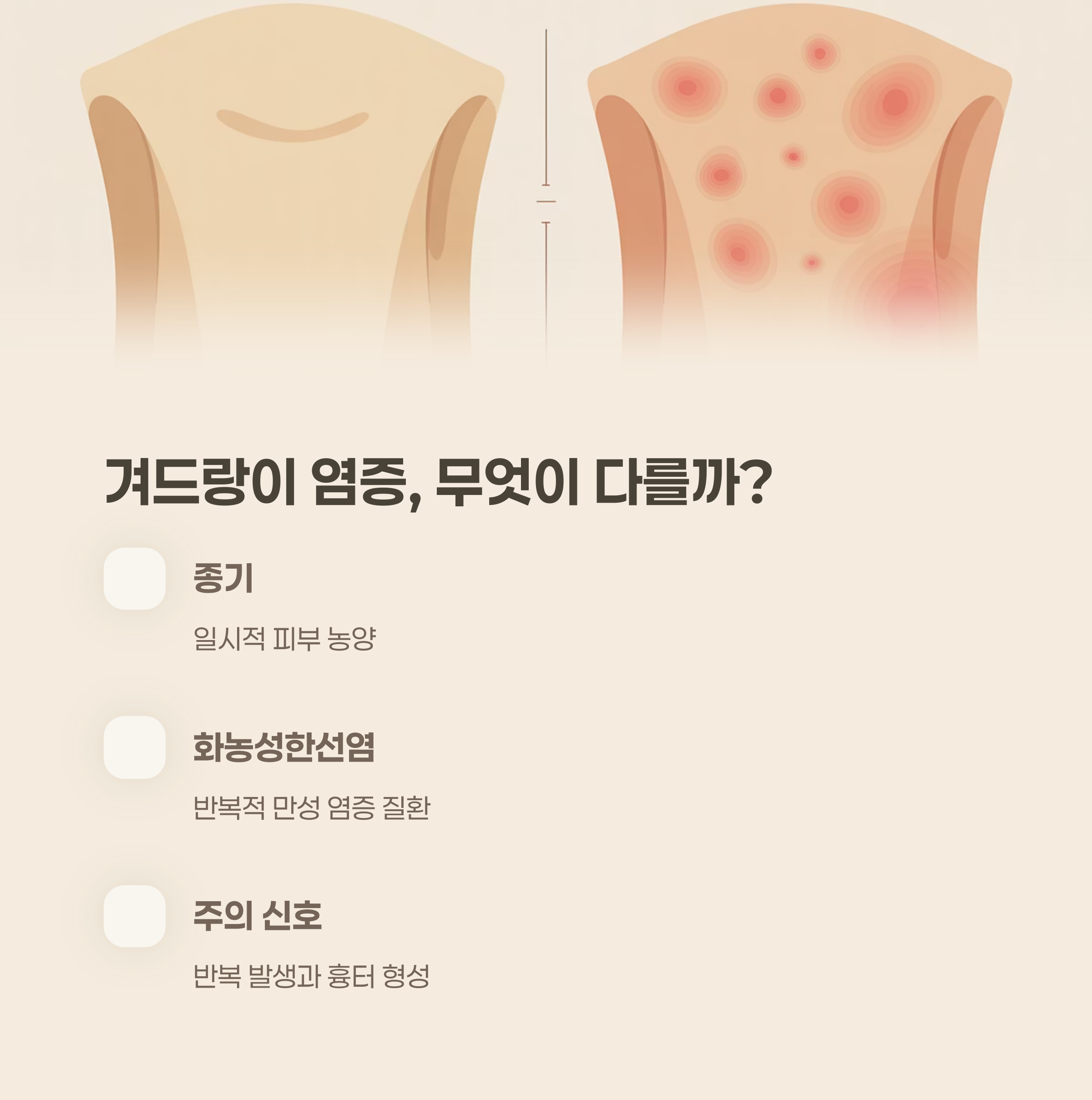 겨드랑이 부위 염증 질환, 무엇이 다를까?