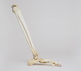 골다공증에 좋은 음식 예방 식단