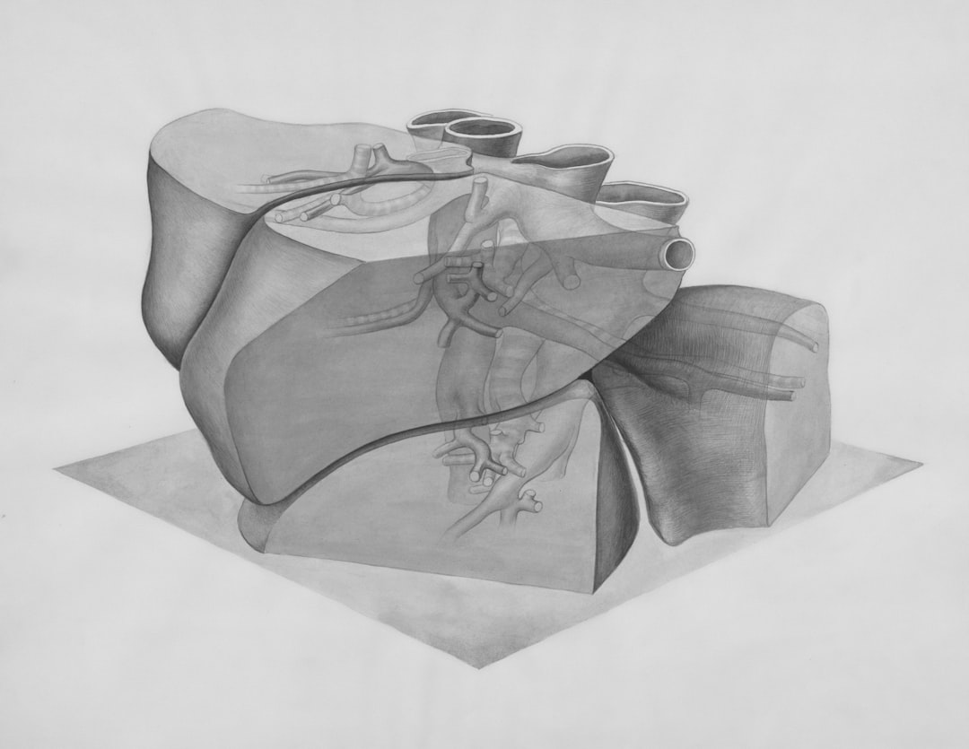 Atrial Fibrillation