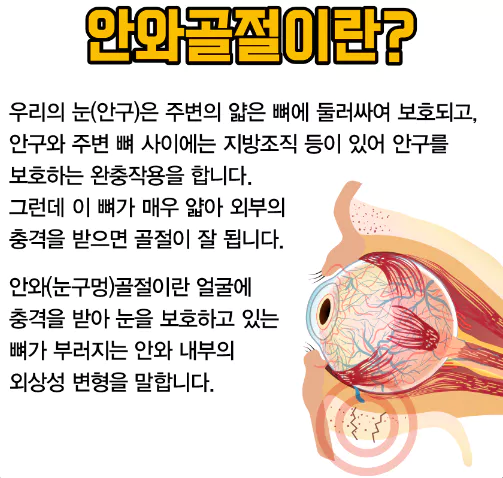 안와골절-정의
