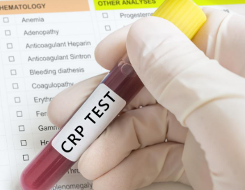 CRP