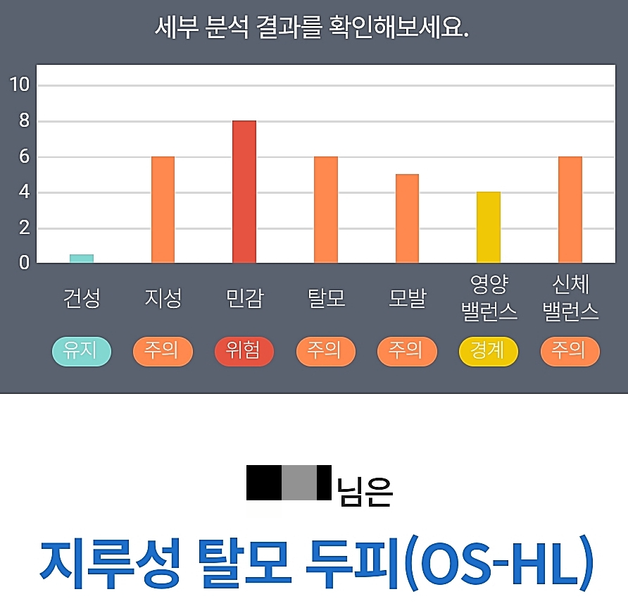 지루성 탈모 두피