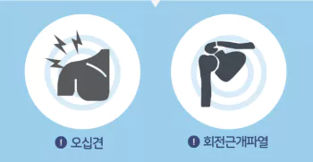 오십견-회전근개-파열-차이5