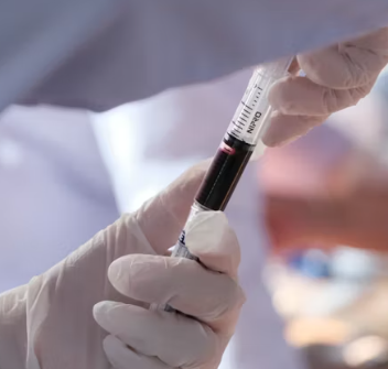 폐경기 생리증상 변화 대처법