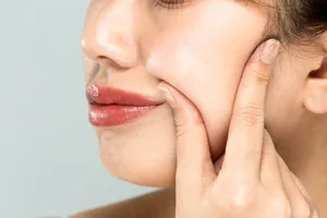 켈로이드 흉터 제거