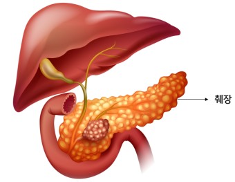 췌장암 통증 부위
