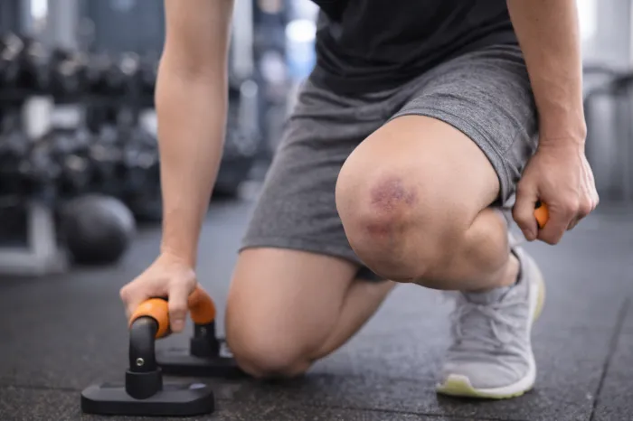 피부에 멍이 잘드는 이유