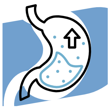 역류성식도염증상