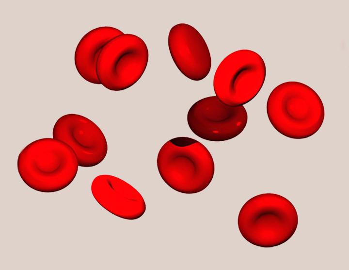 적혈구-이상-증상