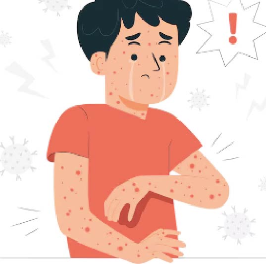 대상포진 초기 증상