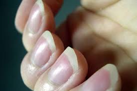 손톱 색깔로 보는 건강