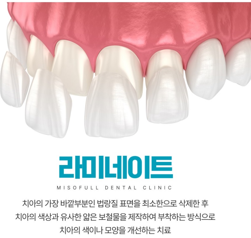 라미네이트 설명 사진