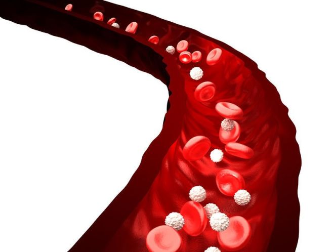 triglycerides 정상 수치