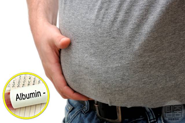 간암 증상 생로병사의비밀 복수 배에 물 차는 증상