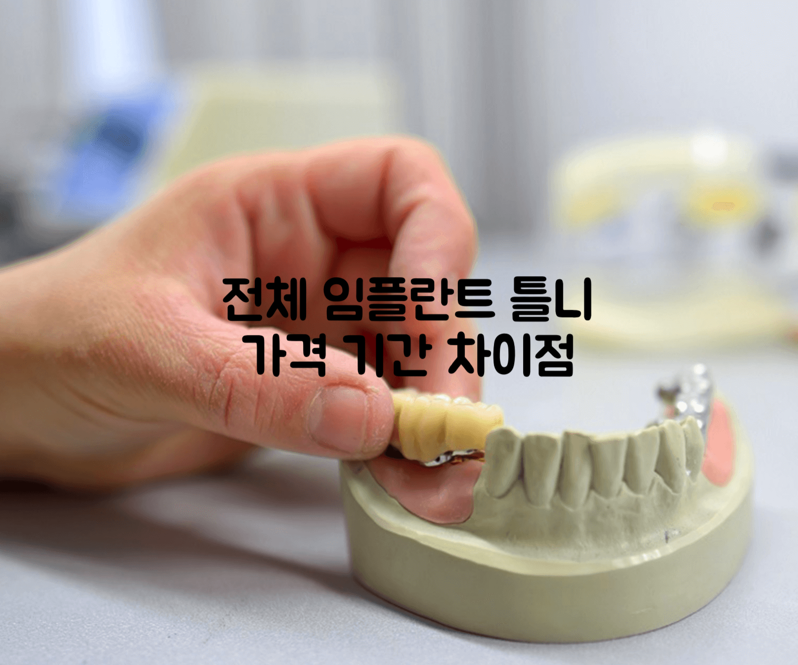 전체임플란트