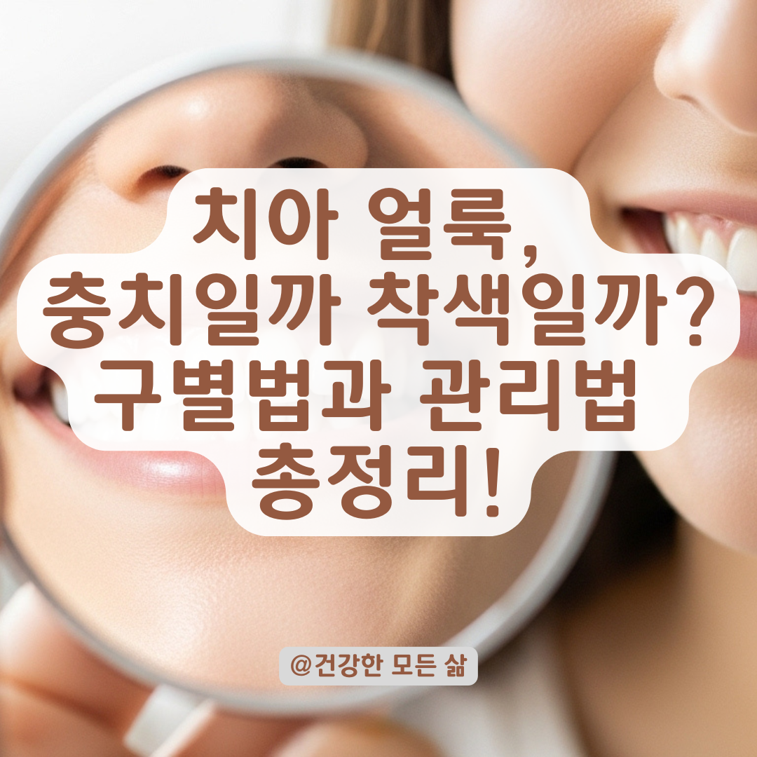 치아에 갑자기 생긴 얼룩, 충치인지 착색인지 구별하는 방법 정리.