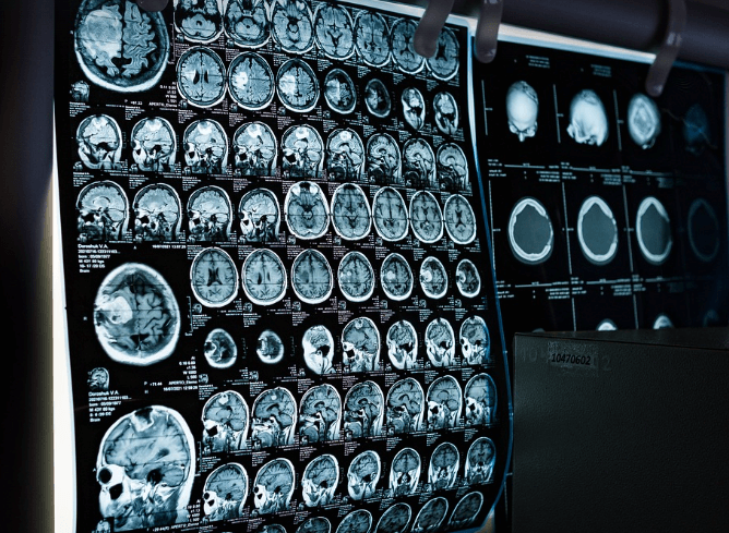 혈압 낮추는 음식 추천