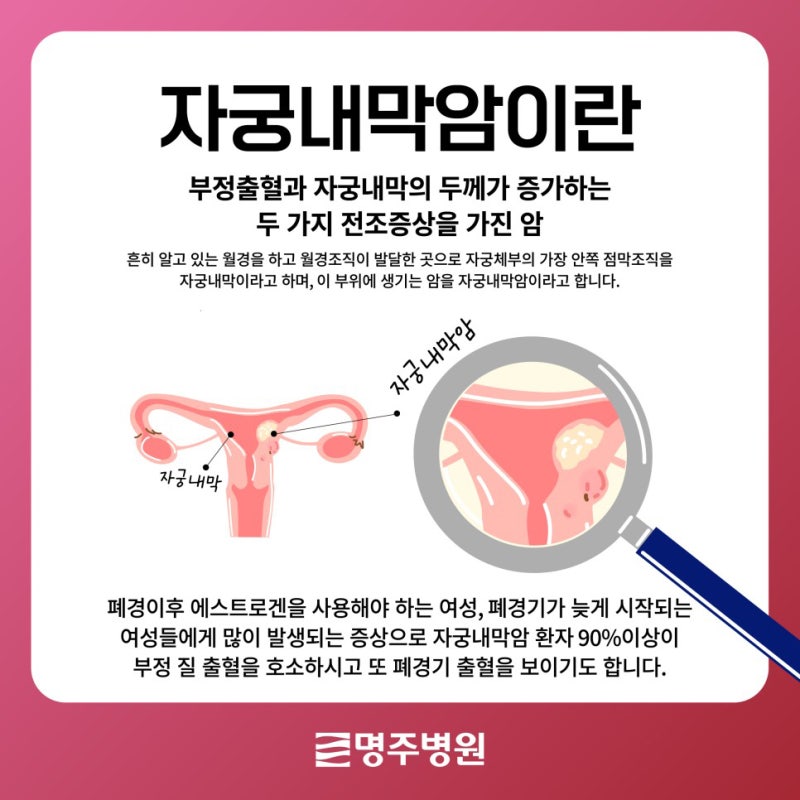 자궁내막암