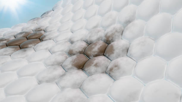 검버섯 기미 차이 없애는 방법 법 레이저 연고 박피 크림