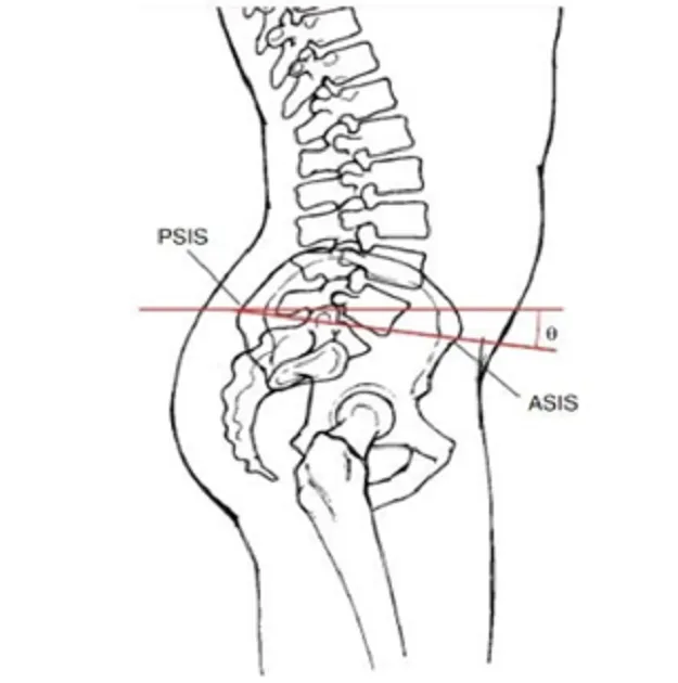 Pelvicangle