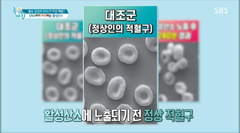 숨만 쉬어도 활성 산소가 생긴다?